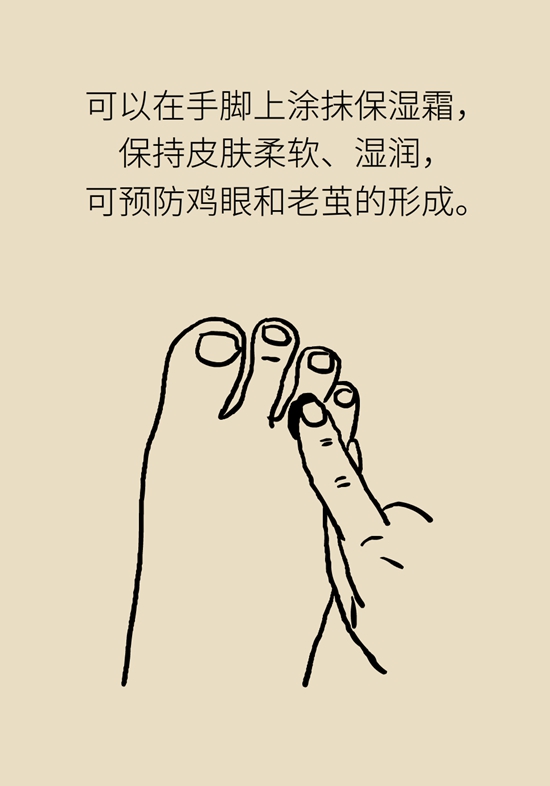 長了雞眼和老繭怎麼辦？這份防治指南請收好