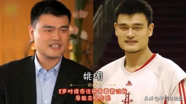 12位隱藏極深的明星身體缺陷,吳京6歲斷指 12位隱藏極深的明星身體缺陷,吳京6歲斷指