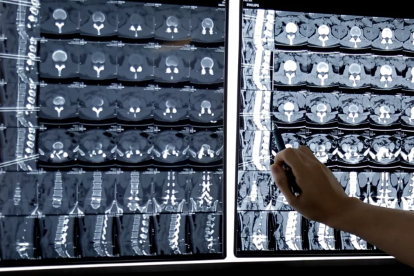 「健康資訊」擼串意外感染“怪病”?我emo了 「健康資訊」擼串意外感染“怪病”?我emo了