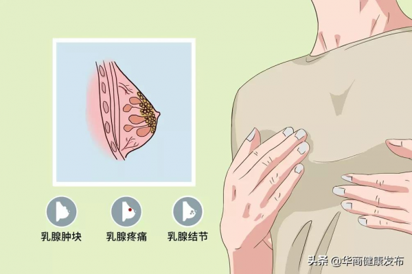33歲女性乳腺惡性病變？針灸為其治療乳腺增生症
