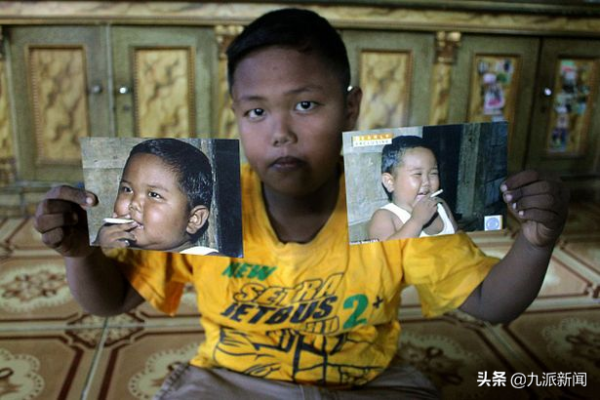 2歲成老煙槍，印尼男童曾1天抽40支菸，戒菸後身心大轉變