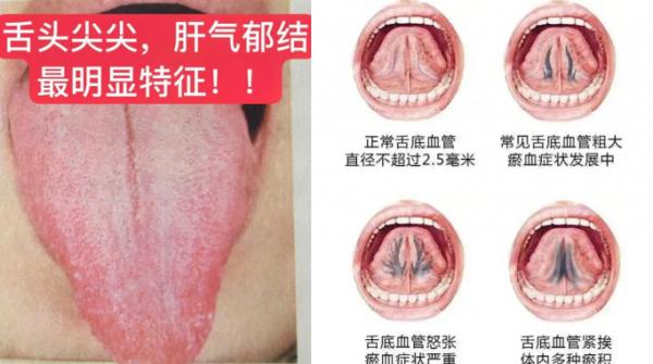 九種常見體質,你是哪一種? 九種常見體質,你是哪一種?