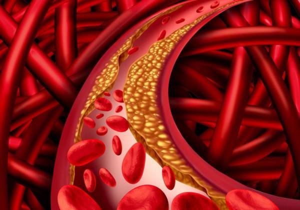 高血糖的危害大嗎？詳細瞭解這2種高血糖誘發的併發症，就明白了