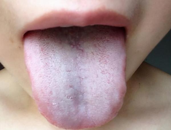 “舌為心之苗”:心臟不好,舌頭或許有4個變化,對照自查下 “舌為心之苗”:心臟不好,舌頭或許有4個變化,對照自查下