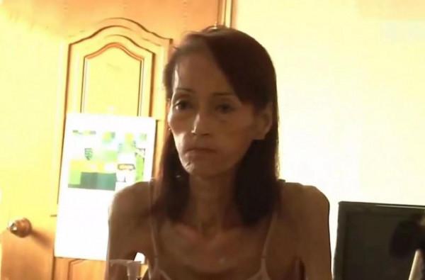 韓國女人瘦到皮包骨頭，生活無法自理，年輕時卻是大美人