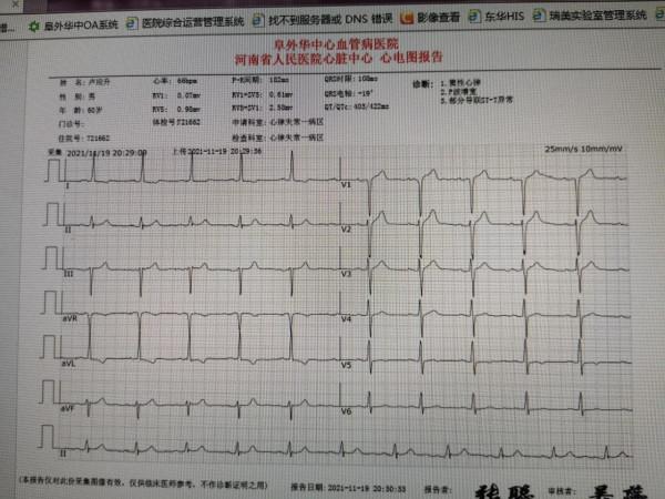 發作時胸悶背痛意識恍惚為哪般？……不一樣的心絞痛
