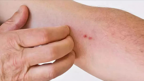 雙腿反映全身病，千萬要留意！腿上的5個疾病訊號，快來自查