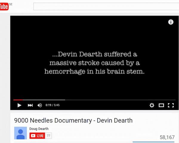 美國健美運動員癱瘓十年，用中醫治療幾天，竟奇蹟般地站了起來