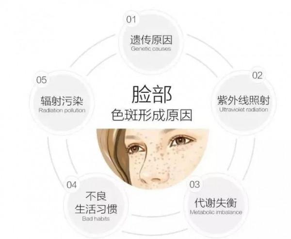 黃褐斑怎麼基本都是長在女生臉上？你看完就知道了