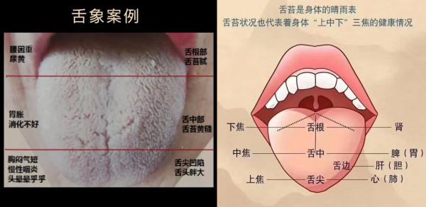 舌診分析：口乾舌燥，乾咳不止，怎麼調理？