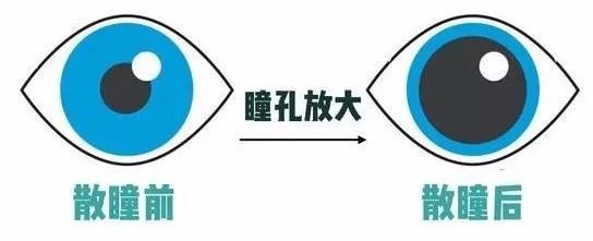 配眼鏡要散瞳嗎？散瞳對眼睛有什麼危害？
