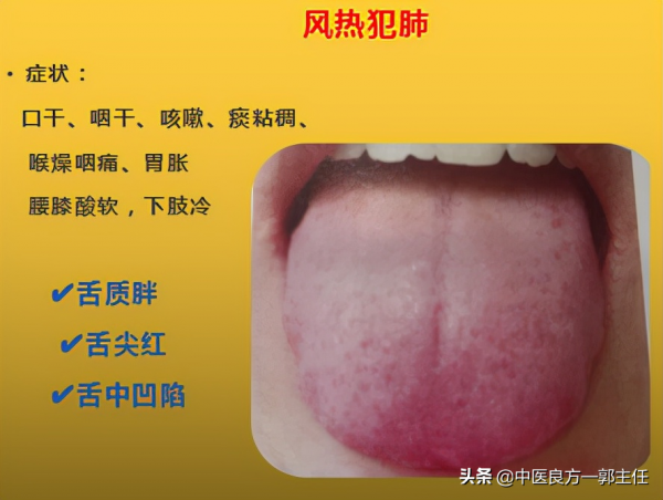 12種“熱”藏於體內,反應的舌象、症狀各不相同,自查便知 12種“熱”藏於體內,反應的舌象、症狀各不相同,自查便知