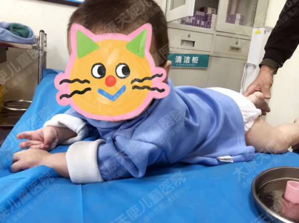 6個月寶寶不僅癲癇還發育遲緩，康復訓練後效果改善