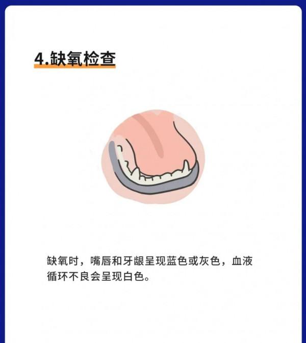 狗狗急救指南！(關鍵時刻可救狗命)