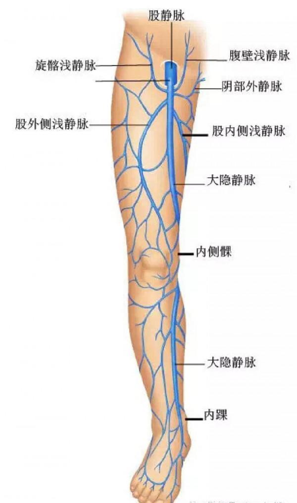 說說大隱靜脈曲張