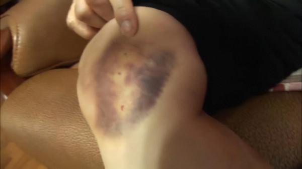 無毛貓對主人無差別攻擊,全家人都不敢靠近喵:現在脾氣太差了 無毛貓對主人無差別攻擊,全家人都不敢靠近喵:現在脾氣太差了