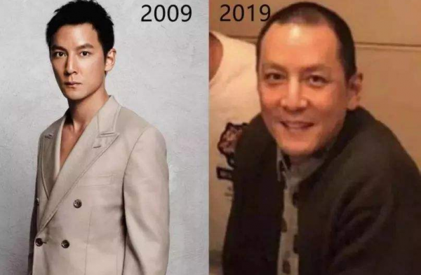 &OpenCurlyDoubleQuote;禿頂&rdquo;危機的9大男神，有人29歲髮際線堪憂，有人戴了多年假髮