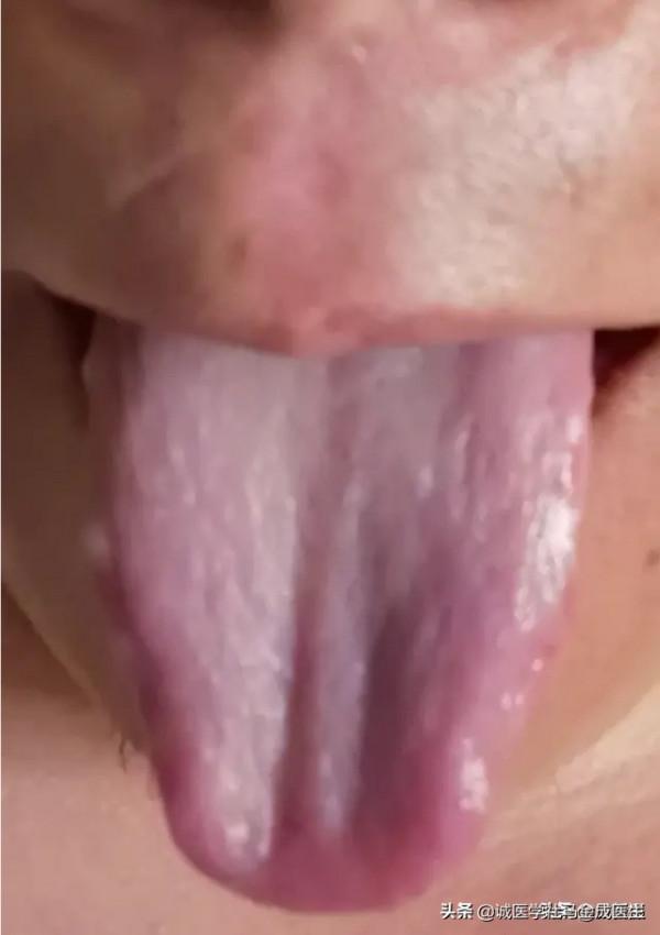 六種不同常見體質，看你屬於哪種，看哪種方法適合你