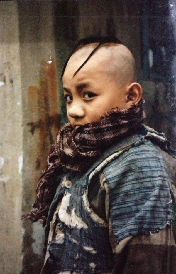 “三毛”長大了!8歲成名,14歲禿頂,34歲變帥哥,植髮挨300多針 “三毛”長大了!8歲成名,14歲禿頂,34歲變帥哥,植髮挨300多針