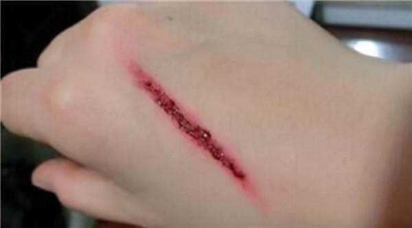 印度一女性睡覺時被毒蛇咬傷,送醫後死亡,毒蛇:這不能怪我 印度一女性睡覺時被毒蛇咬傷,送醫後死亡,毒蛇:這不能怪我