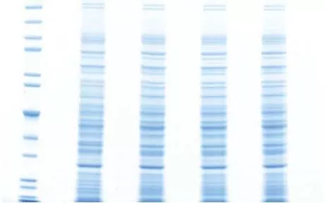 天能VE-586丨Western Blot蛋白免疫印跡常見問題