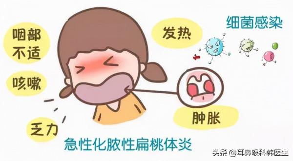 急！扁桃體又發炎了