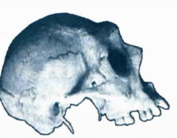 1997年，中科院對“猴娃”進行屍檢，研究者：它是小腦症患者