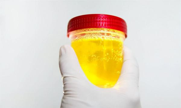 糖尿病患者，除了注意控制血糖外，這3個現象，也不能大意