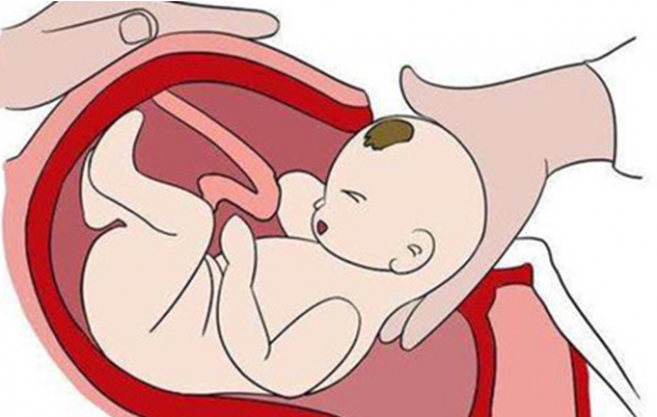 過來人：生娃能順就別&OpenCurlyDoubleQuote;剖&rdquo;！3個隱藏的弊端，產後很難及時發現