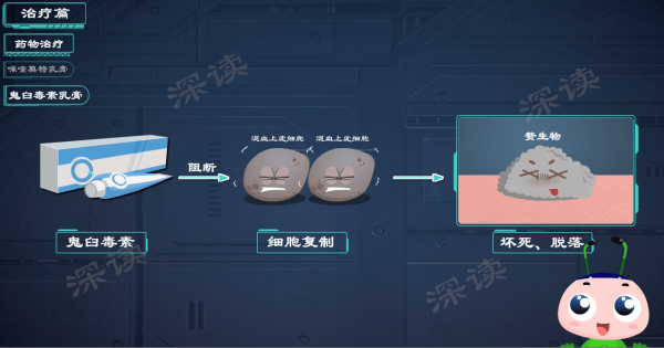藥物腐蝕？液氮冷凍？鐳射灼燒？到底誰才能根治尖銳溼疣？