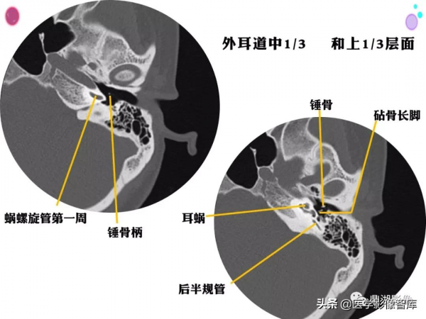CT斷層解剖圖譜最全總結「推薦收藏」 CT斷層解剖圖譜最全總結「推薦收藏」