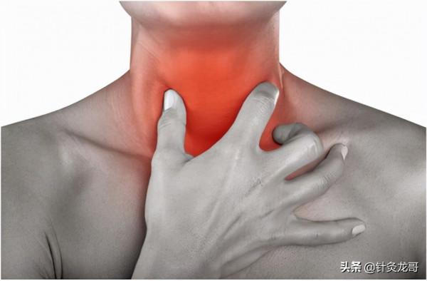 少商穴為什麼可以治療咽喉腫痛? 少商穴為什麼可以治療咽喉腫痛?