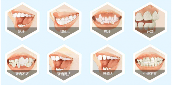 矯牙的三個黃金時期 矯牙的三個黃金時期