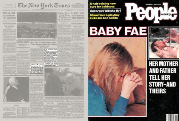 1984年，美國女嬰為活命移植狒狒心臟，手術成功21天后仍然離世