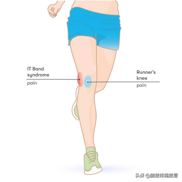 股四頭肌靈活性練習指南和常見損傷 股四頭肌靈活性練習指南和常見損傷