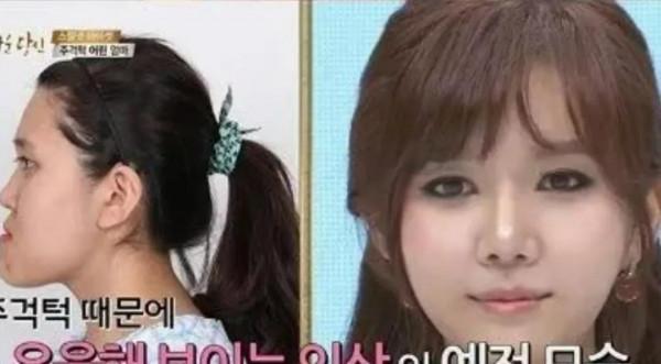 宋智雅當選韓國top長相,但其實是下等臉? 宋智雅當選韓國top長相,但其實是下等臉?