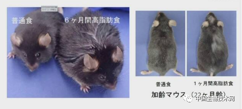 希望來了！“防脫”要補充大豆飲食，一種益生菌或能逆轉“禿頭”