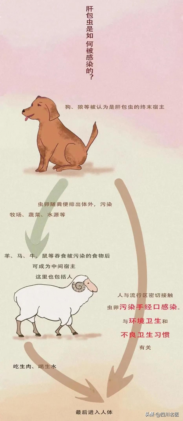 四川31歲男子遭遇“蟲癌”入侵！“咬傷”他肝、膽道、腎上腺…