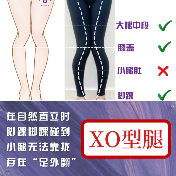 VEMOR變美乾貨｜你瞭解你的腿形嗎？