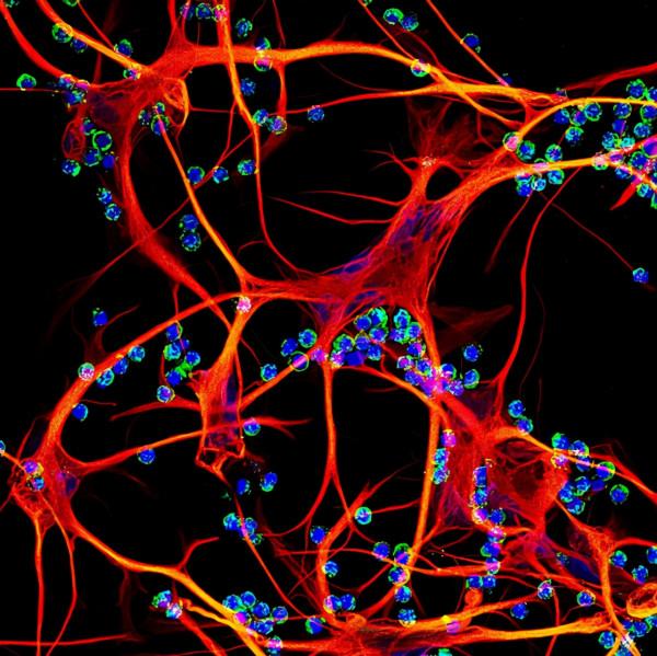人死後，體內的“殭屍基因”開始活躍，試圖復活人類