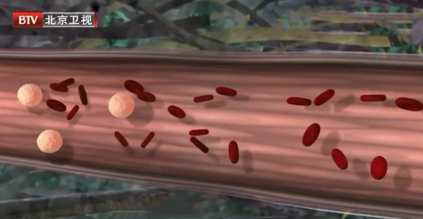 比久坐更傷身！7個常見壞習慣，損面板、傷血管、毀骨骼&hellip;