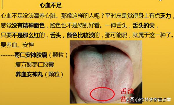 治療失眠的中成藥大總結,失眠、多夢、入睡困難再也不怕用錯藥 治療失眠的中成藥大總結,失眠、多夢、入睡困難再也不怕用錯藥