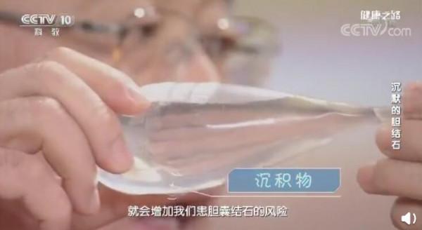 不吃早餐到底有多不健康？經常餓一頓或引發膽結石