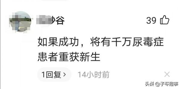 國外豬腎移植人體試驗,成功了嗎?權威專家給出答案 國外豬腎移植人體試驗,成功了嗎?權威專家給出答案