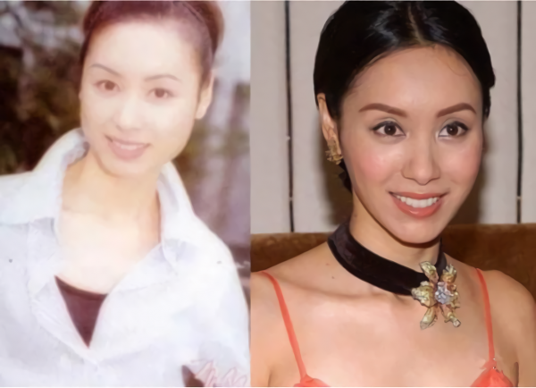 那些“一刀切”削臉的明星還好嗎？有的已垮掉，小方臉成最後贏家