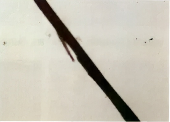 頭髮根部的小白點是什麼?掉了不能長出頭髮? 頭髮根部的小白點是什麼?掉了不能長出頭髮?