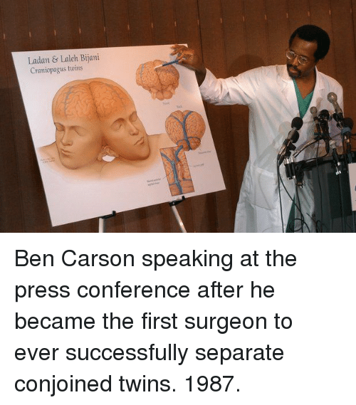 伊朗著名連體雙胞胎姐妹，29歲冒險做分離手術，分開兩小時殞命