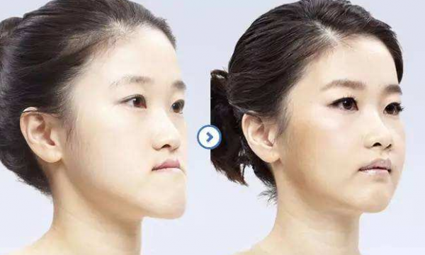 牙齒畸形，只知道“地包天”？各種畸形一文講清