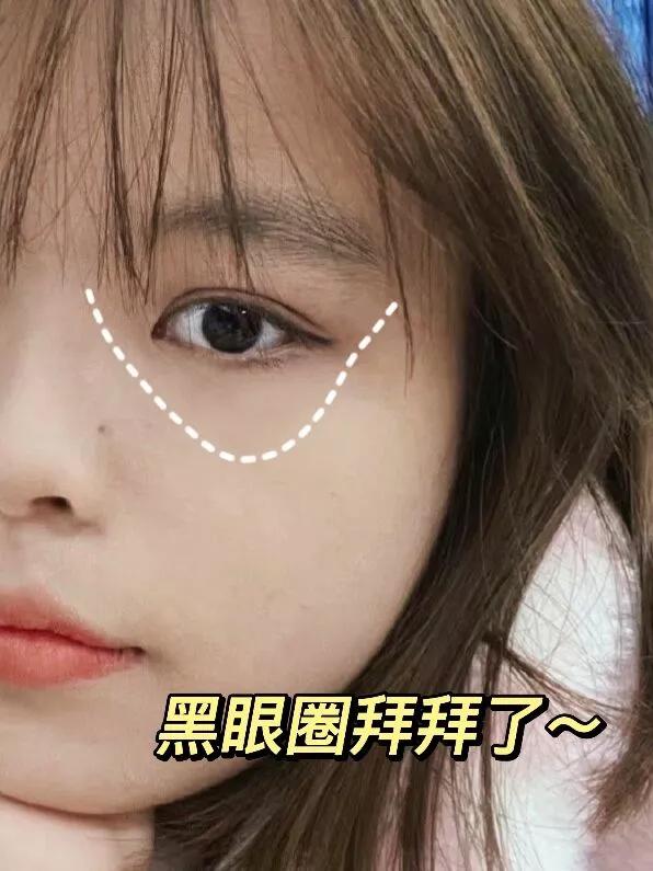 用這方法去黑眼圈果然快準狠