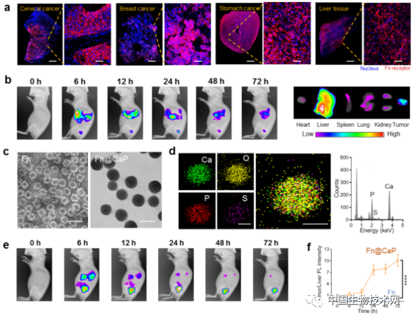 仿生礦化鐵蛋白用於實體腫瘤靶向遞送研究獲進展